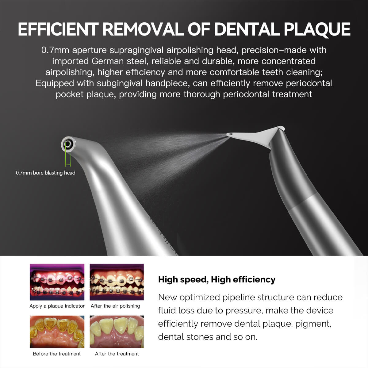 Dental Air Polisher Nozzles Gingival & Subgingival Sandblasting Handle - azdentall.com