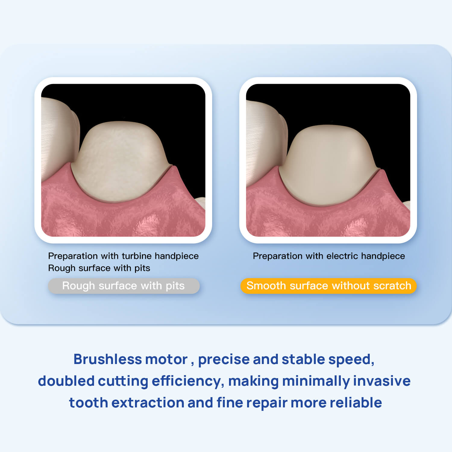 AZDENT Dental LED Electric Brushless Surgery Motor System Touch Screen with Water Supply - azdentall.com