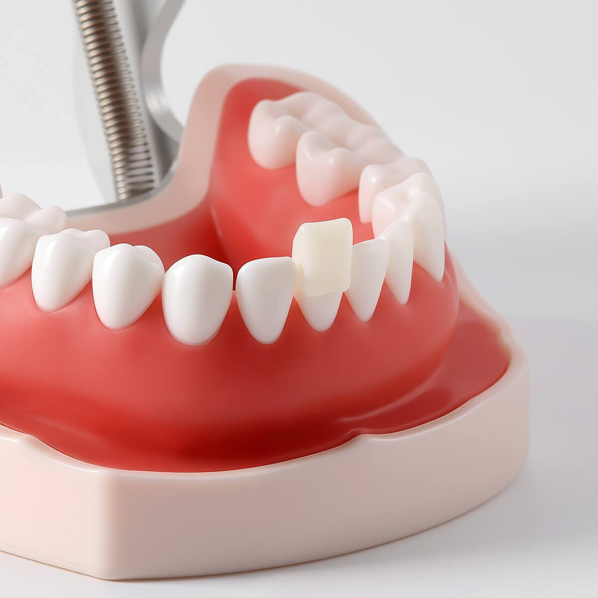 Dental Temporary Resin Teeth Crown Material for Anterior Molar Posterior Teeth 50pcs/Bag - azdentall.com