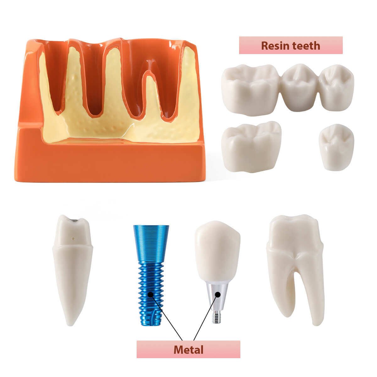 Dental 4 Times Implant Teeth Model Analysis Crown Bridge Demonstration Removable - azdentall.com