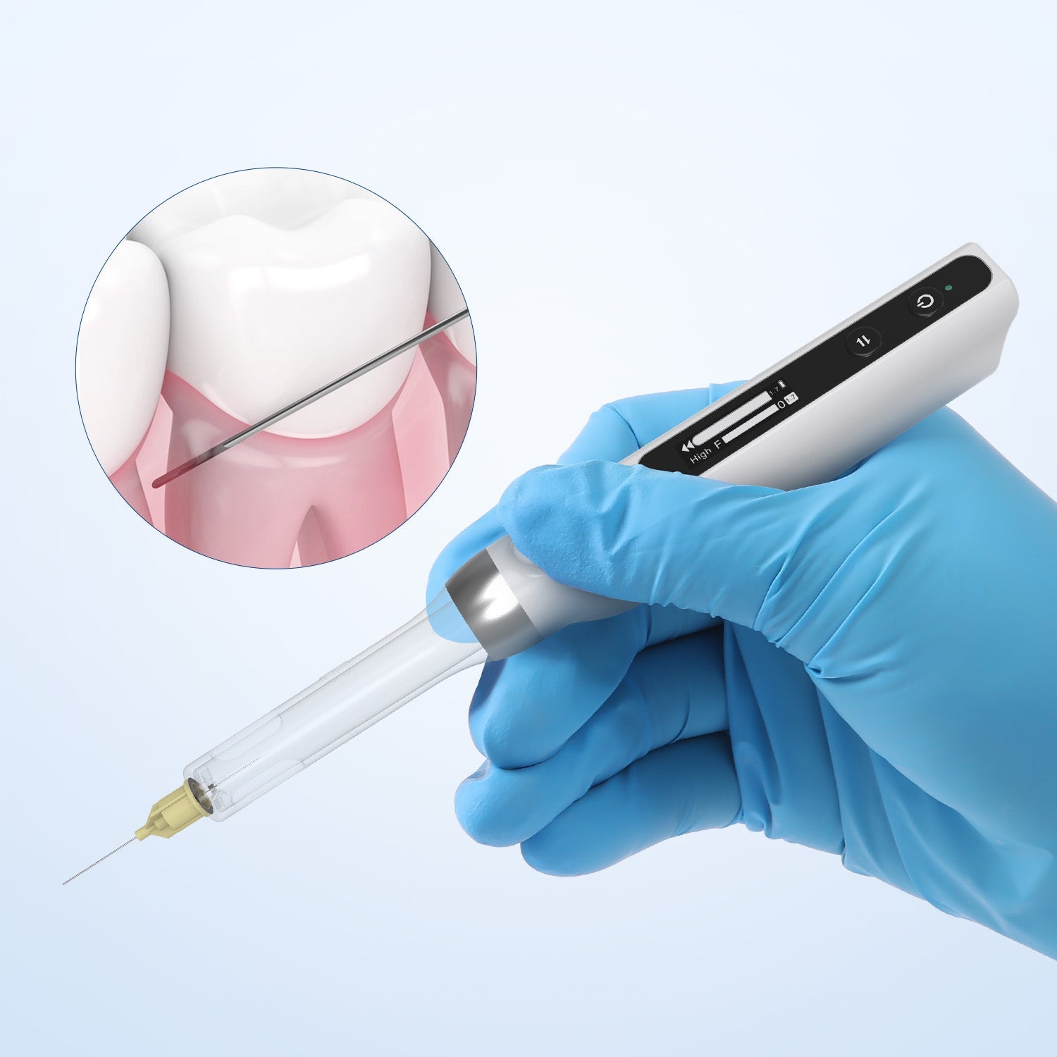 Dental Professional Painless Oral Local Anesthesia Mini Device - azdentall.com