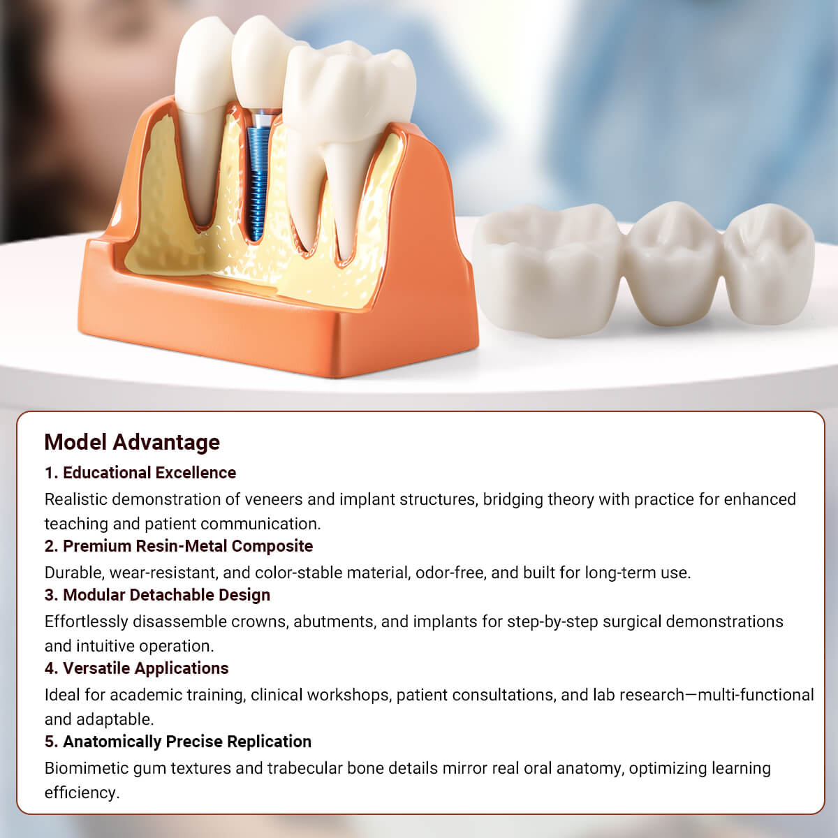 Dental 4 Times Implant Teeth Model Analysis Crown Bridge Demonstration Removable - azdentall.com