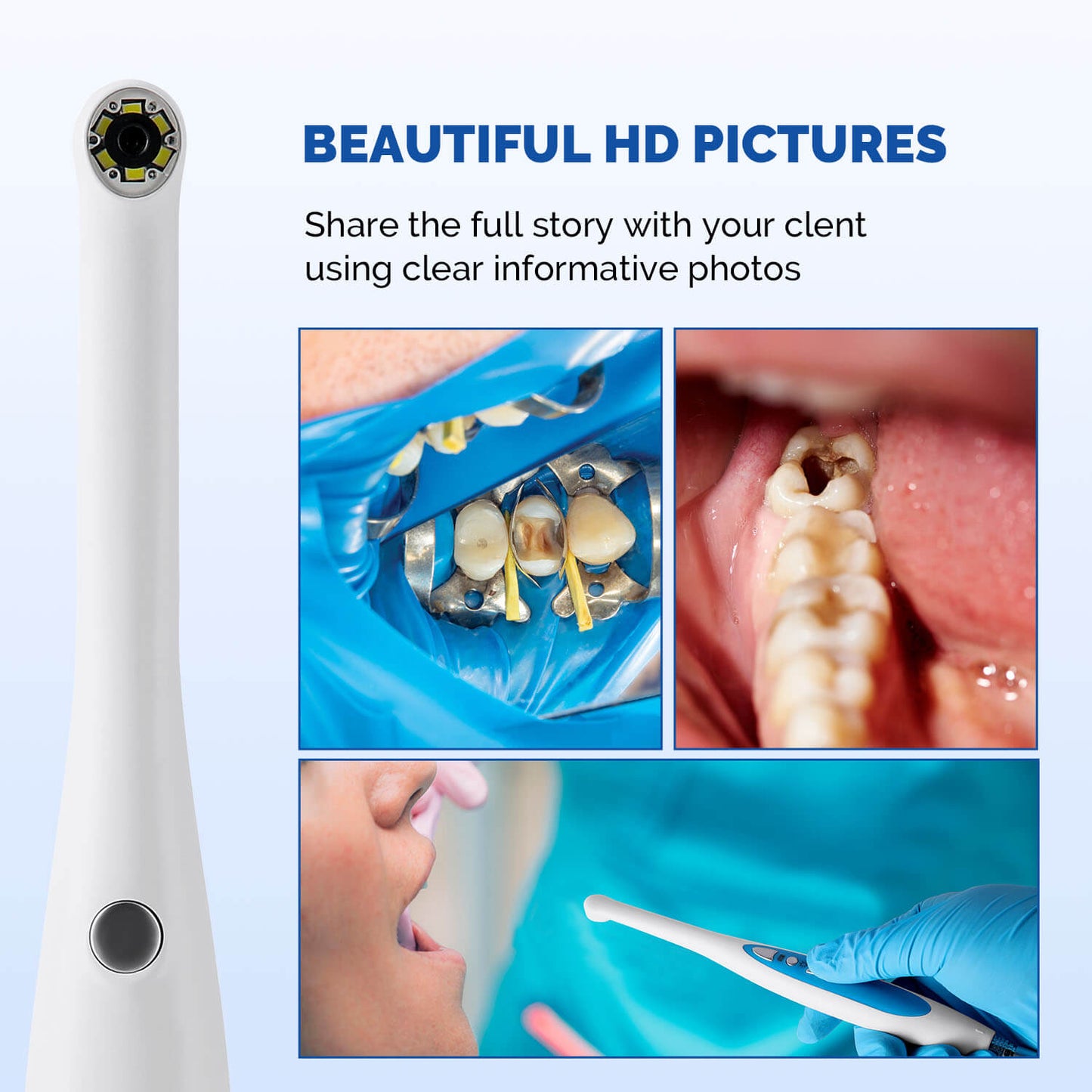 Dental USB Digital HD Intraoral Camera 6 LED White Lights AF Auto-focus - azdentall.com