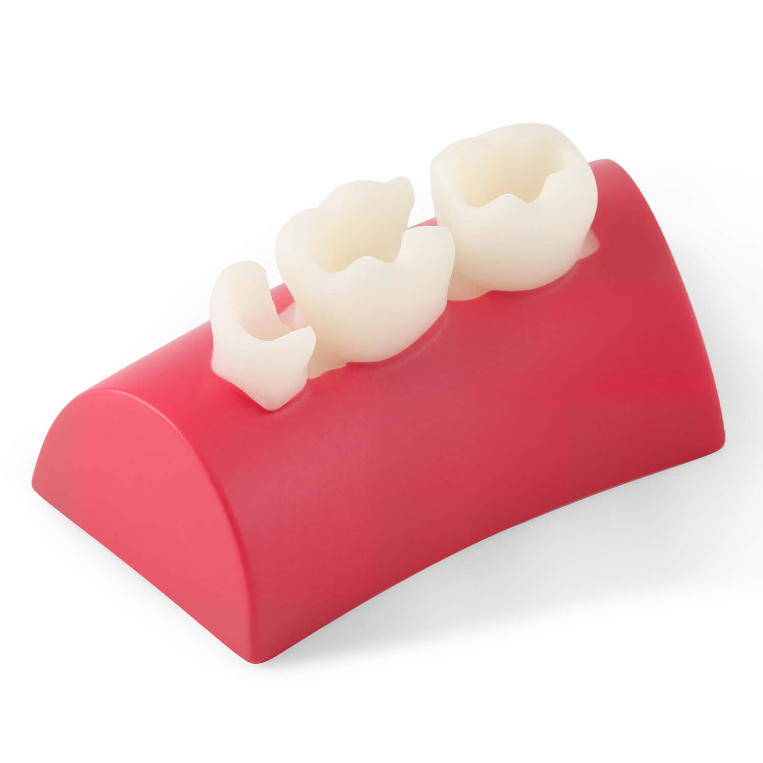 Dental Inlay Exercise Block Composite Resin Filling Teeth - azdentall.com