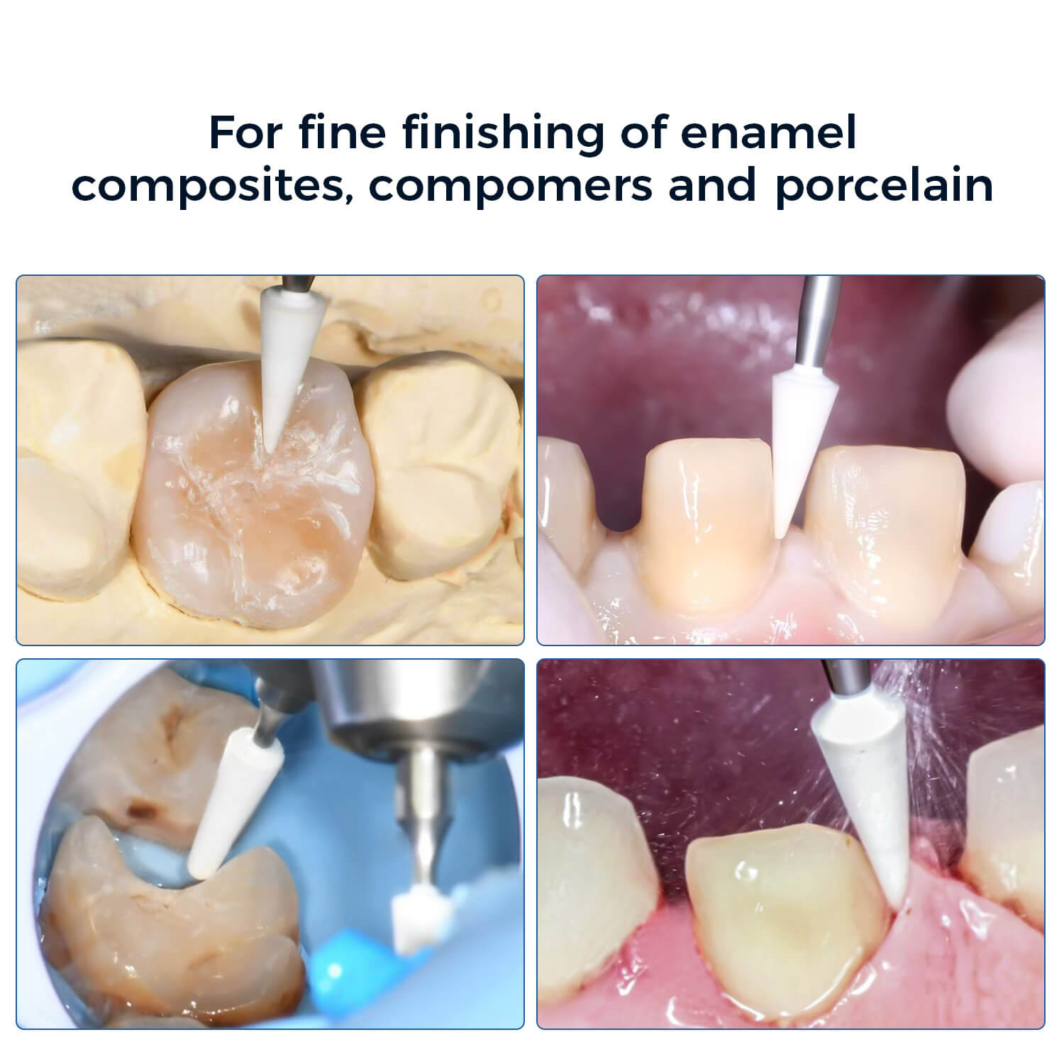 Dental Polishing White Stones FG Mixed Shapes 5pcs/Set - azdentall.com