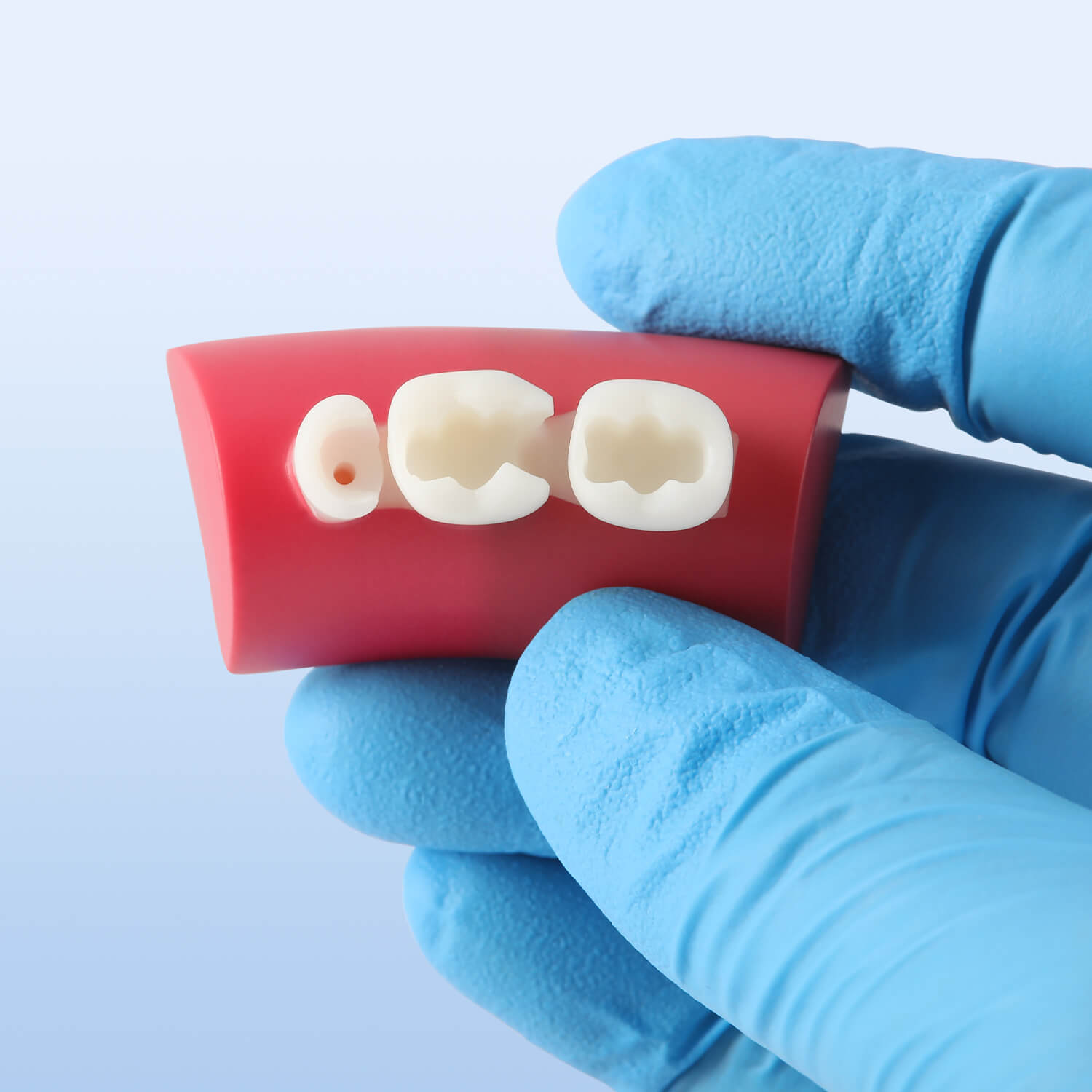 Dental Inlay Exercise Block Composite Resin Filling Teeth - azdentall.com