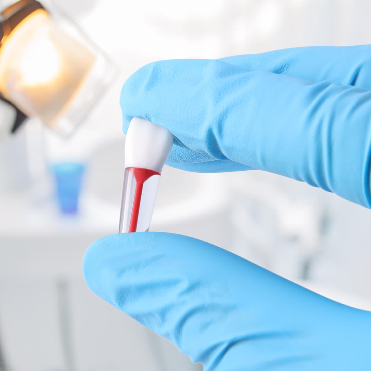 Dental Endo Teeth Model Transparent Root Canal Practice Block RCT Pulp Cavity Study Training Teaching - azdentall.com