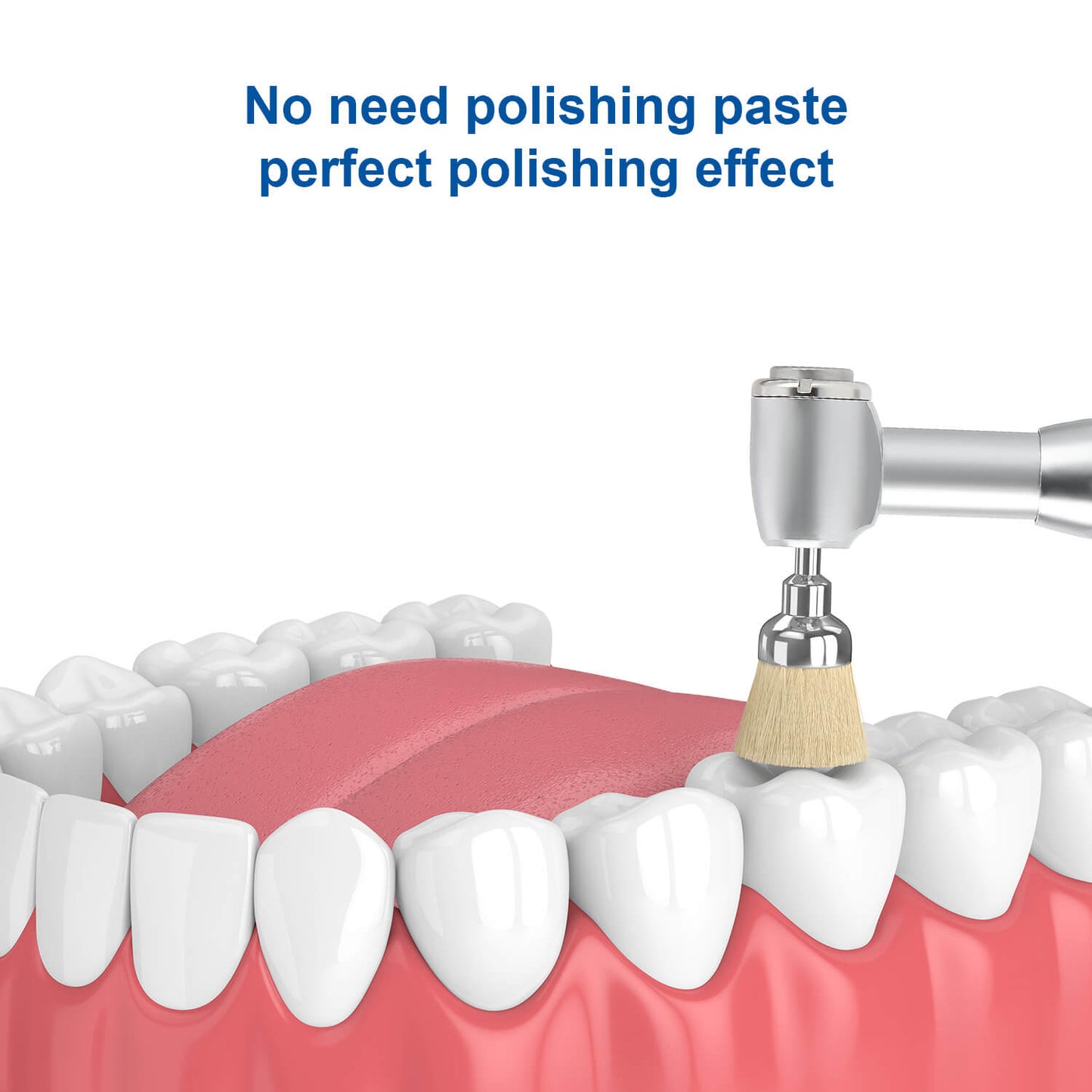 Dental Bristle Prophy Polishing Brush Bowl Shape 10pcs/Pack - azdentall.com