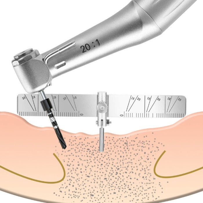 Dental Implant Locating Guide Surgical Planting Positioning Locator Angle Ruler Guage Autoclavable