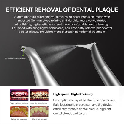 Dental Air Polisher Nozzles Gingival & Subgingival Sandblasting Handle - azdentall.com