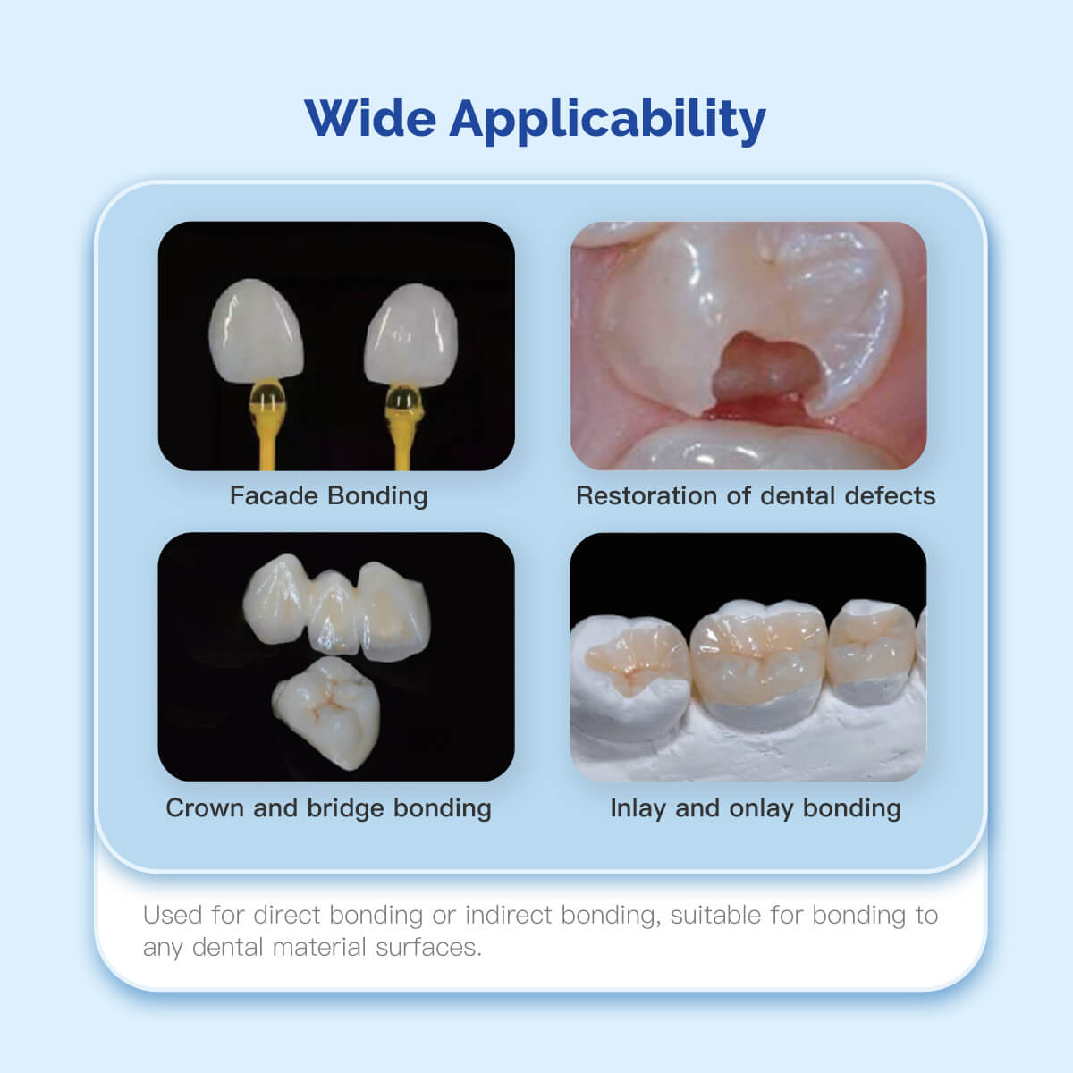 Dentex Dental Light Cure Universal Adhesive Bonding Agent Self-etch Gel 5ml - azdentall.com