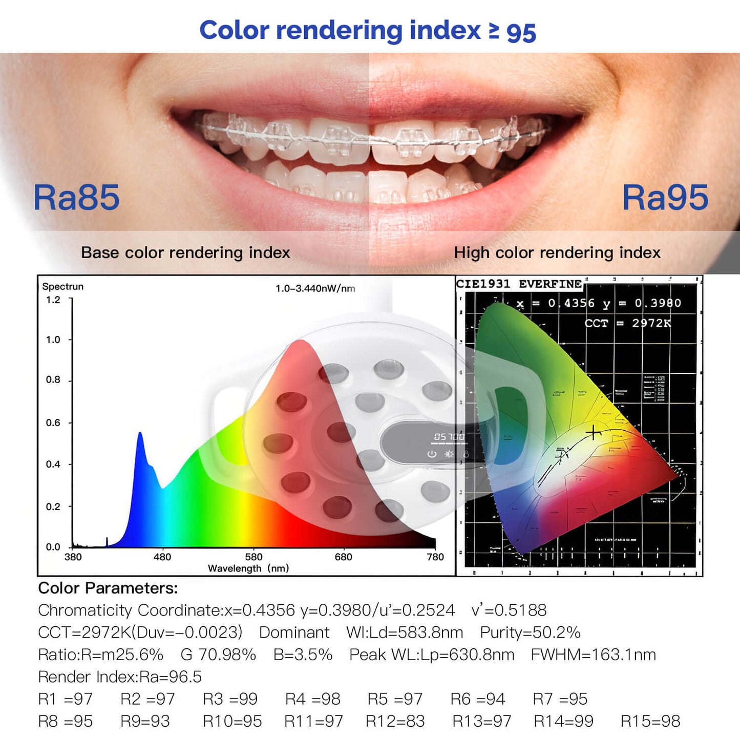 Dental Unit Chair LED Oral Light Lamp 12 Lights 20W Dual-Color Adjustable - azdentall.com