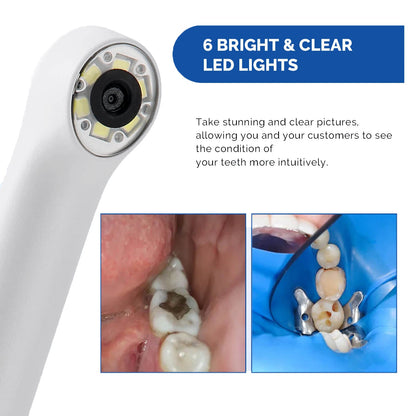 Dental USB Digital HD Intraoral Camera 6 LED White Lights AF Auto-focus