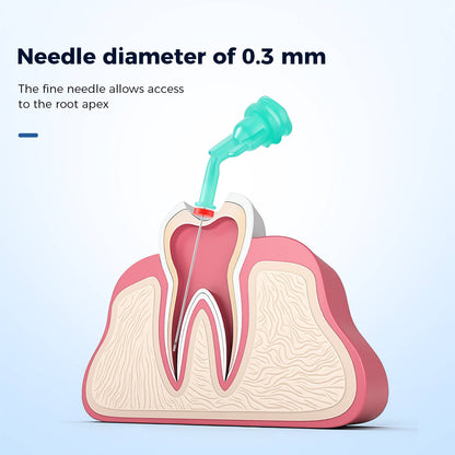 Dental Irrigation Endo Pre-Bent Needle Tip Double Side Hole 20pcs/Box - azdentall.com