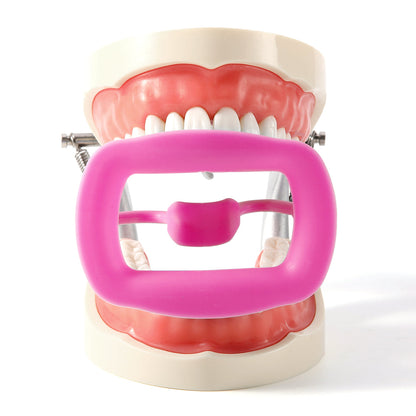 Dental Soft Mouth Opener Orthodontic 3D Intraoral Lip Cheek Retractor Pink - azdentall.com