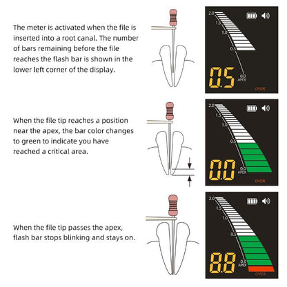 Dental Apex Locator Root Canal + Endo Motor LED Mini 16:1 Contra Angle