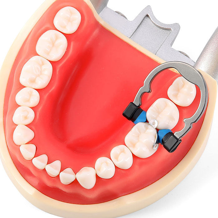 Dental Sectional Matrix System Nickel Titanium Matrices Clamp Clip Ring Small/Medium - azdentall.com