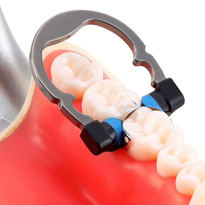 Dental Sectional Matrix System Nickel Titanium Matrices Clamp Clip Ring Small/Medium - azdentall.com