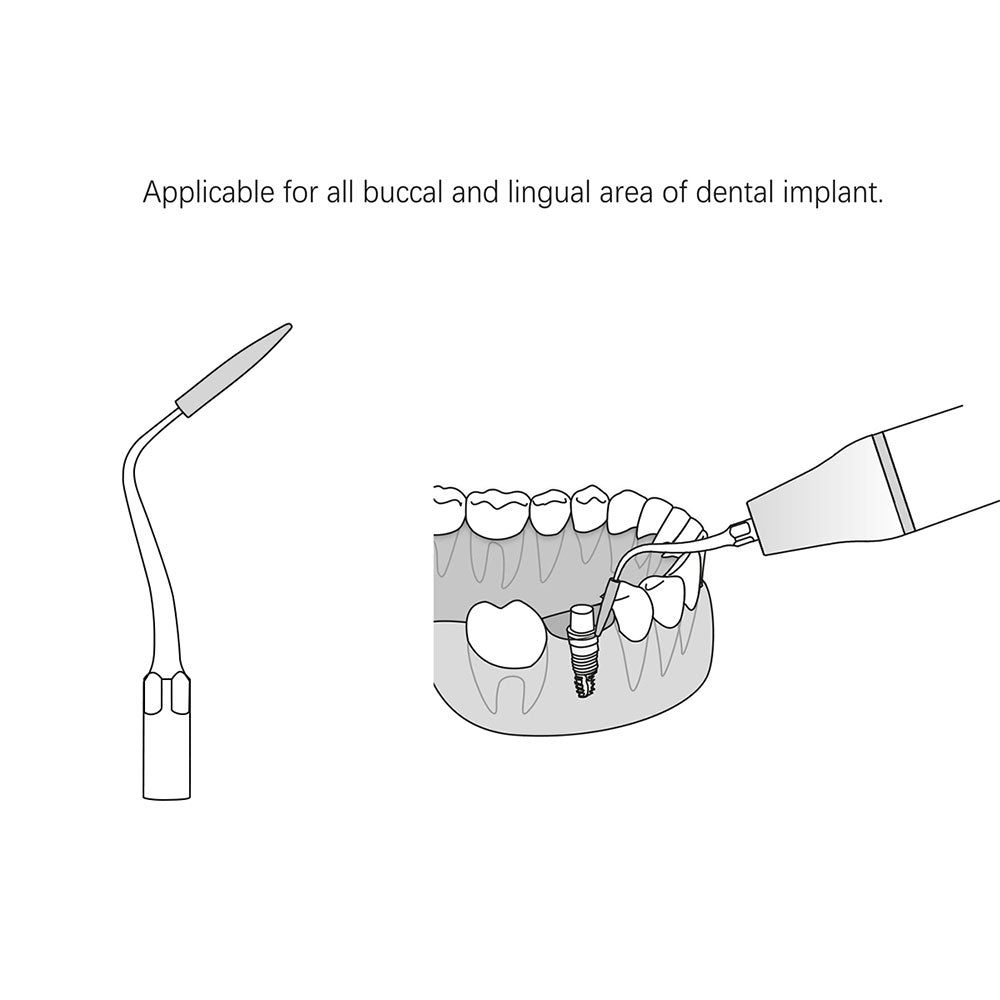 Dental Scaler Tip Periodontal Implant Cleaning Tip P90