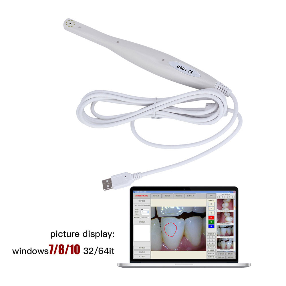 Dental USB Intraoral Camera 8 LED Light High Resolution CMOS 1/4 Sensor
