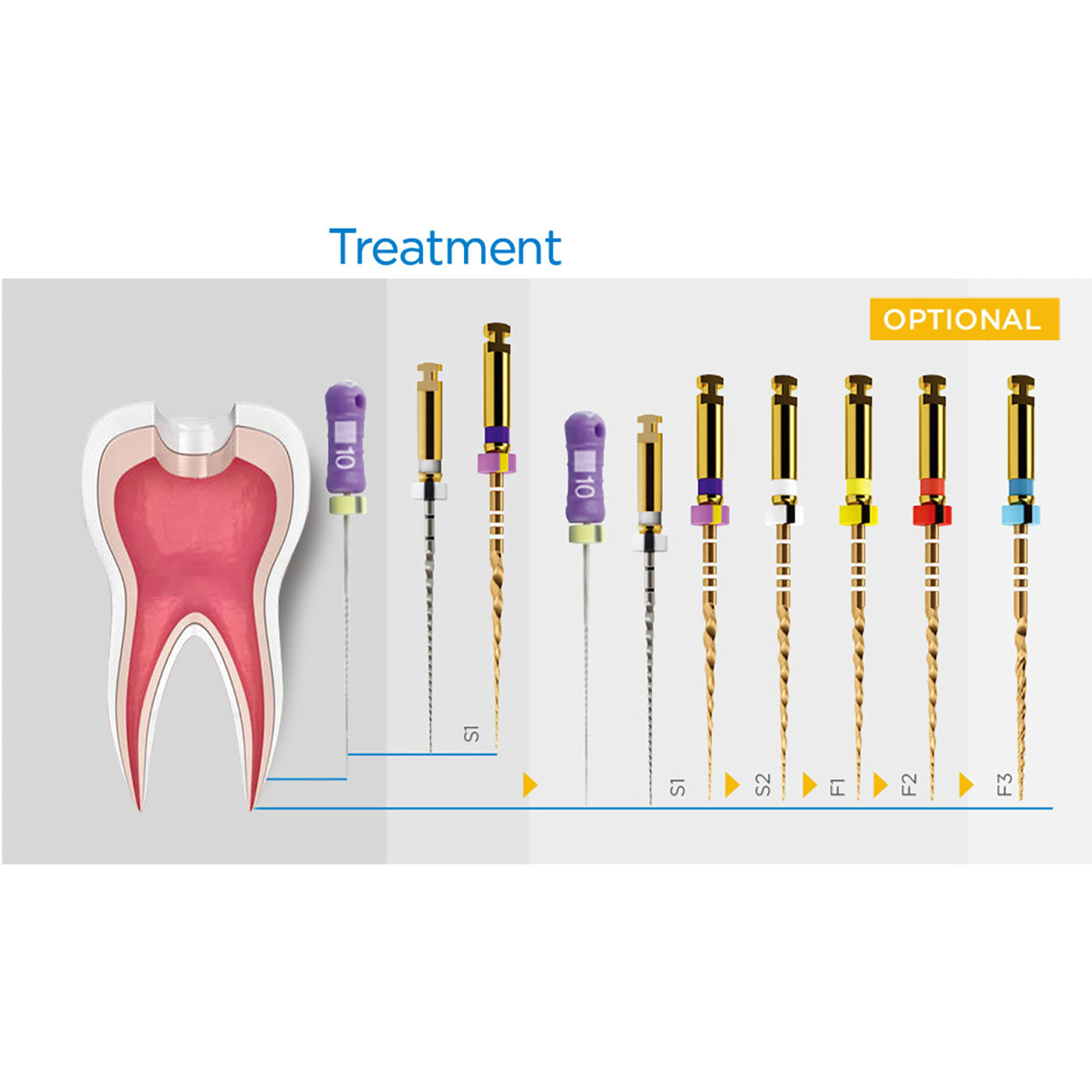 AZDENT Dental NiTi Protaper Rotary Engine Files 25mm Assorted SX-F3 Gold Taper 6pcs/Pk-azdentall.com