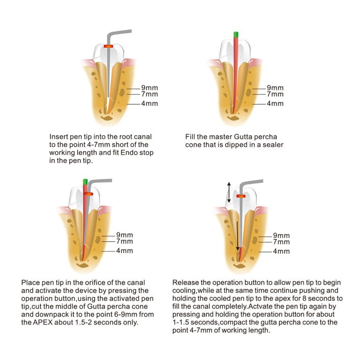 Dental Wirelesss Gutta Percha Obturation Endo Heated Pen-azdentall.com