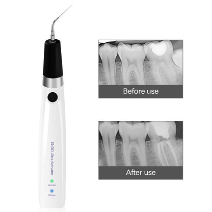 Dental Ultrasonic Activator Irrigator with 6 Tips Cordless Ultrasonic Operation 300° Rotation-azdentall.com